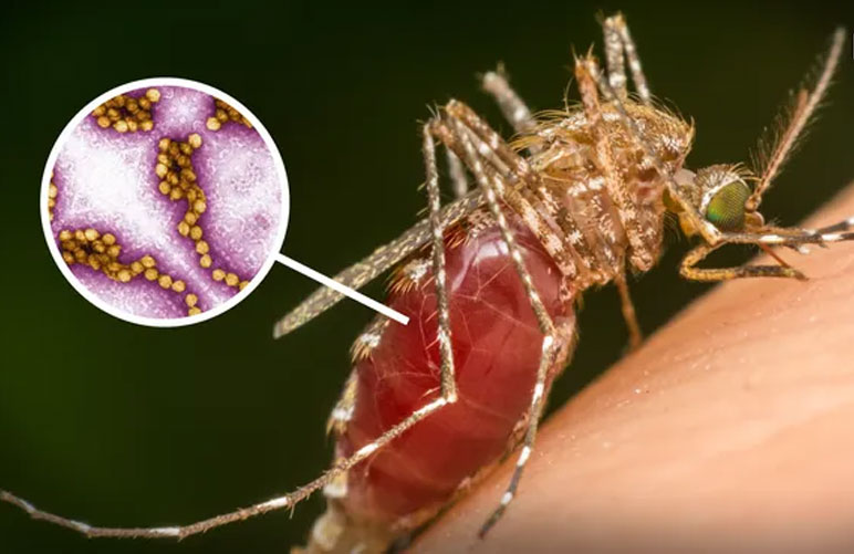 Muỗi đốt mang Virus West Nile